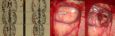 RMN angiografica